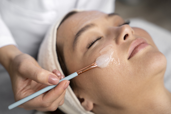 Chemical Peels